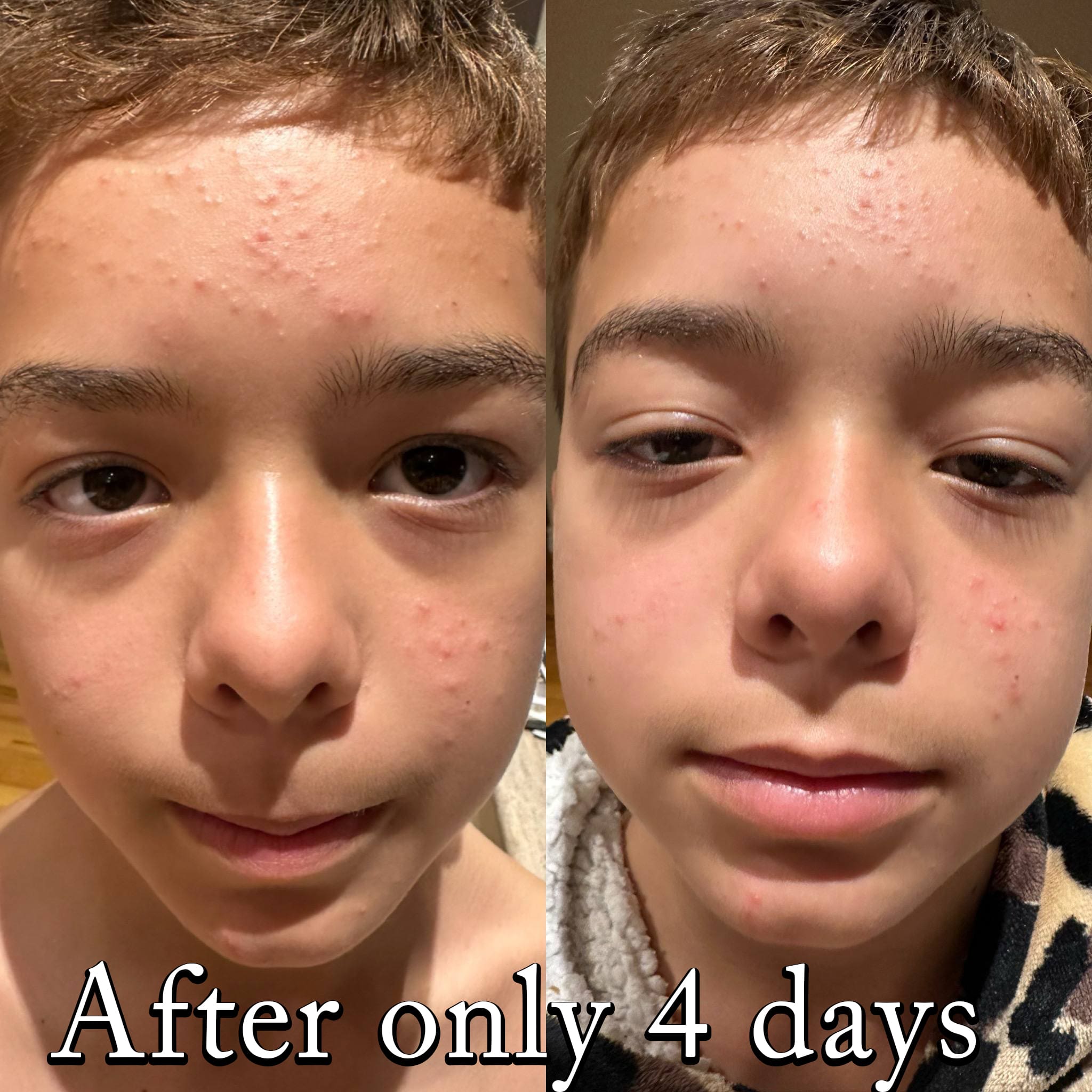 Rapid Healing